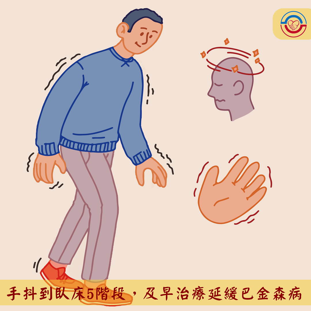 手抖到臥床5階段，及早治療延緩巴金森病