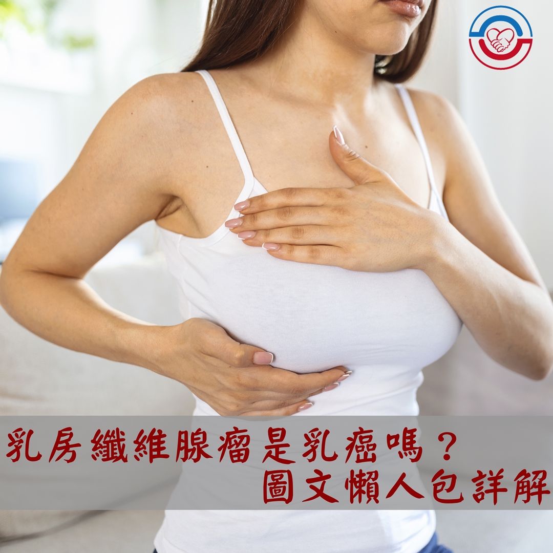 乳房纖維腺瘤是乳癌嗎?圖文懶人包詳解