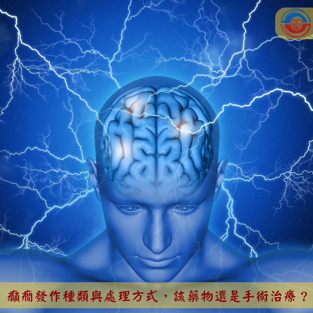 癲癇發作種類與處理方式，該藥物還是手術治療？