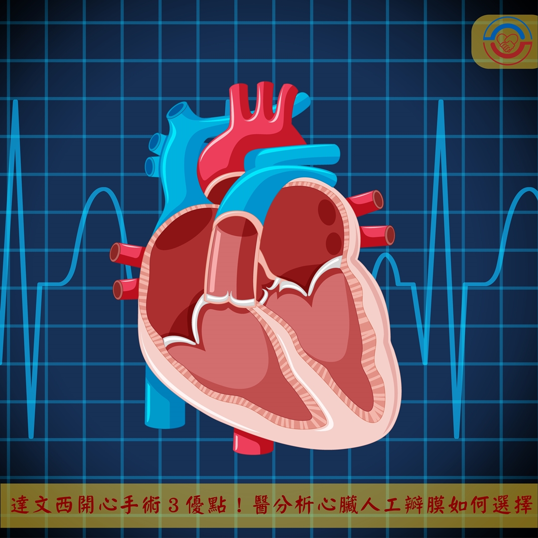 達文西開心手術３優點！醫分析心臟人工瓣膜如何選擇！